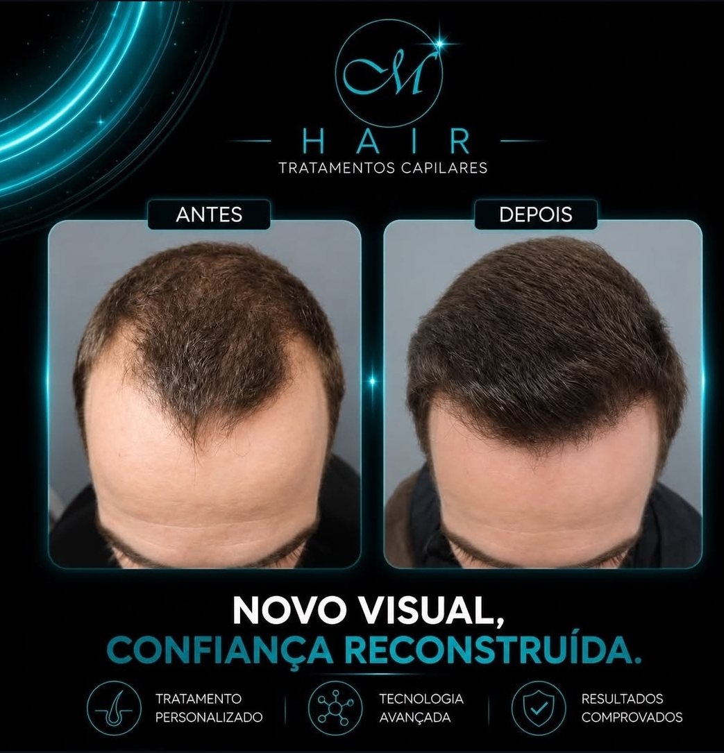 Antes e depois - M Hair